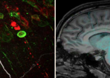 Francia: Workshop Advanced Methods for Preclinical Alzheimer Research